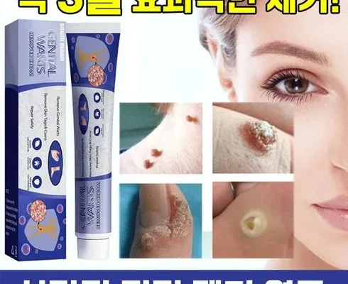 놓치면 후회할 곤지름연고 리뷰